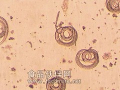 联合国列举影响健康十大寄生虫  猪肉绦虫居首